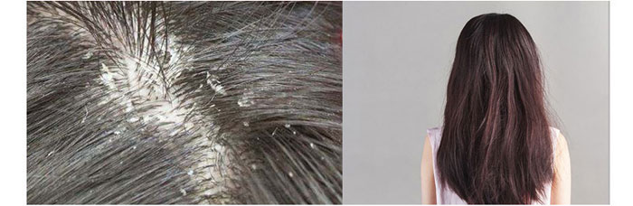 茶氏家族-山茶籽調(diào)理精油 茶氏家族-山茶籽調(diào)理精油