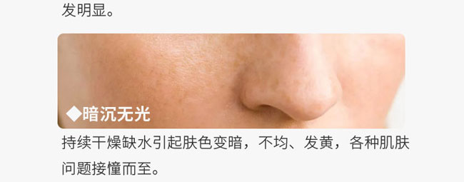 �C��ѩ�wõ�����ױ���Ħ��