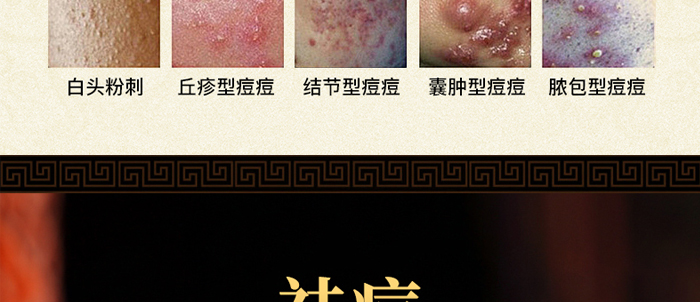 �琂�òݱ�ֲ����M��