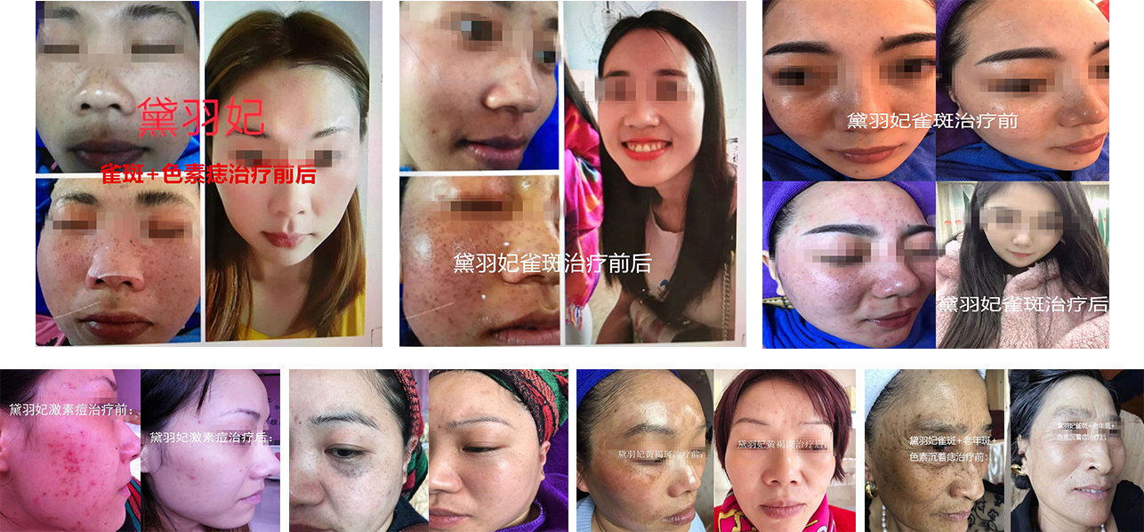 �������ί�ǰ��Ч����(du��)�ȈD